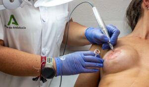 Pigmentación areola mama